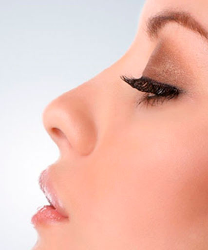 Rinoplastia Doctora Loaiza Aguilar